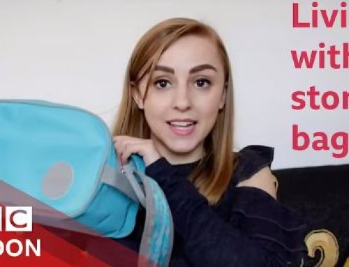 Living with a stoma bag (feat Hanna Witton) – BBC London